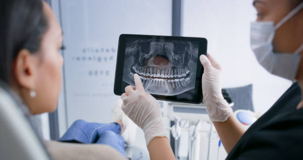 Licensed Teeth Cleaning And Checkup service in Farmersville, OH - Smile Center Dentistry